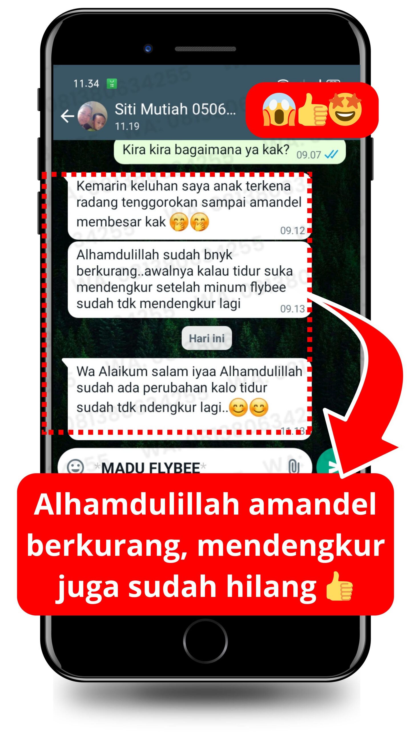 Testimoni FLYBEE ngorok hilang