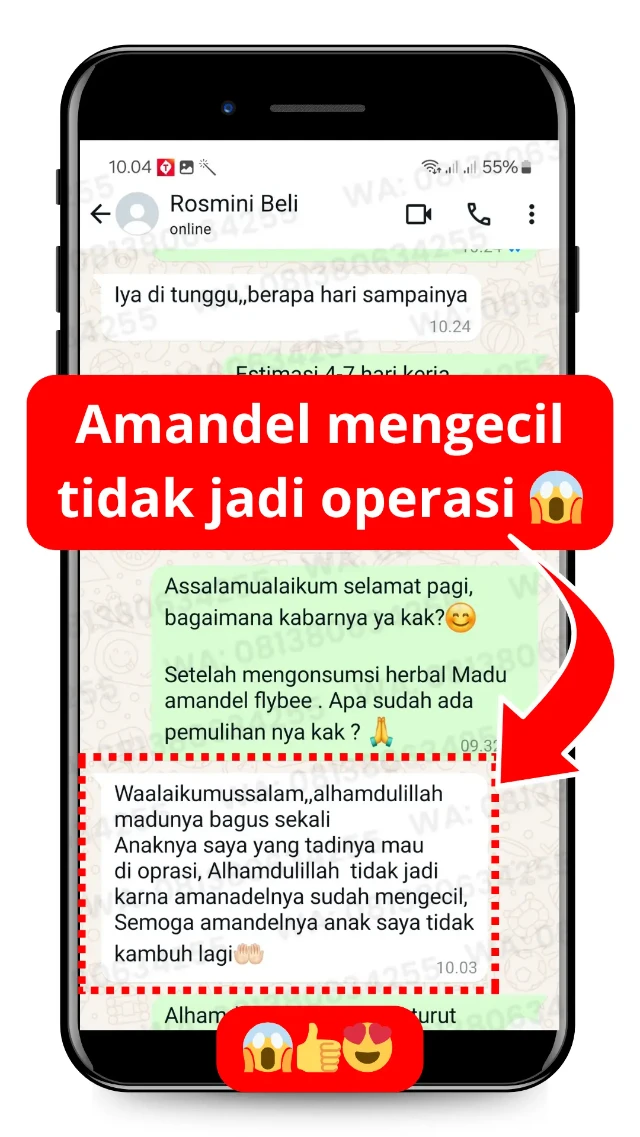 Testimoni FLYBEE tidak jadi operasi