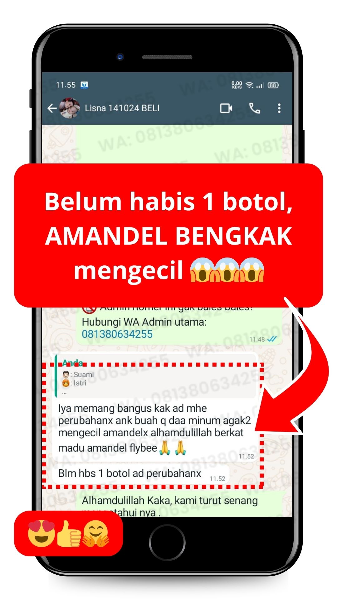 Testimoni FLYBEE amandel mengecil