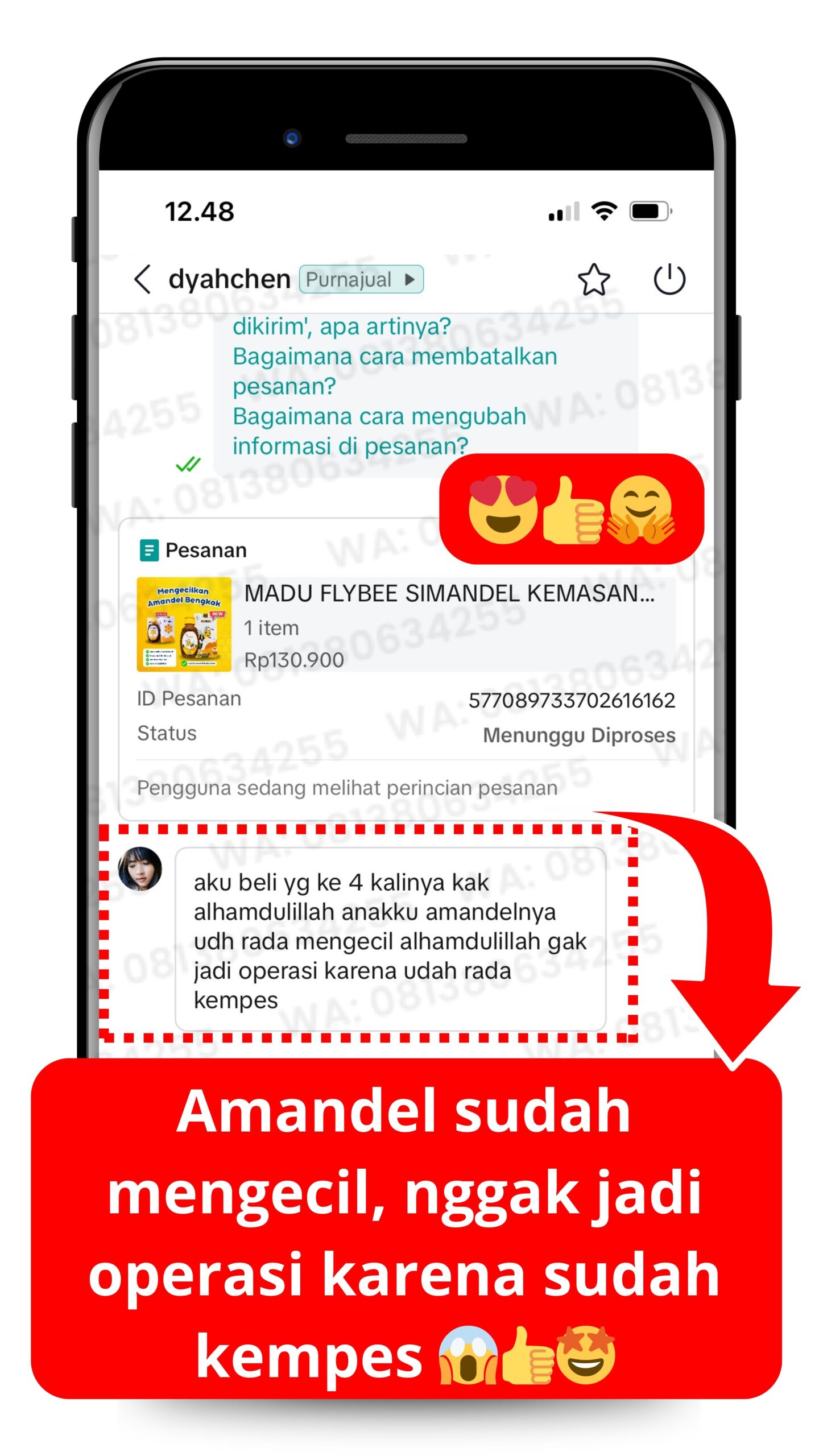 Testimoni FLYBEE tanpa operasi